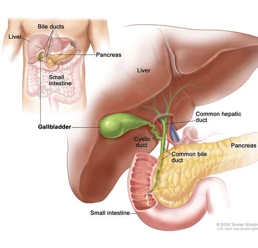 gall bladder surgery .png