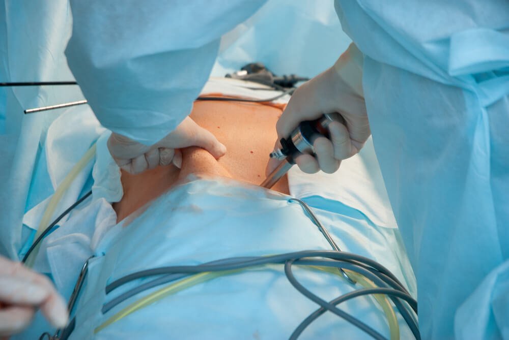 Risks of Gallbladder Removal Surgery