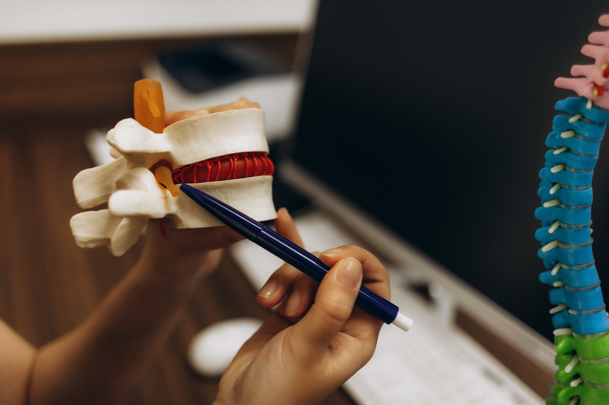 Doctor shows intervertebral hernia to a patient in his office.