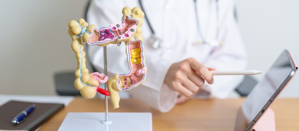 Doctor with human Colon anatomy model and tablet.